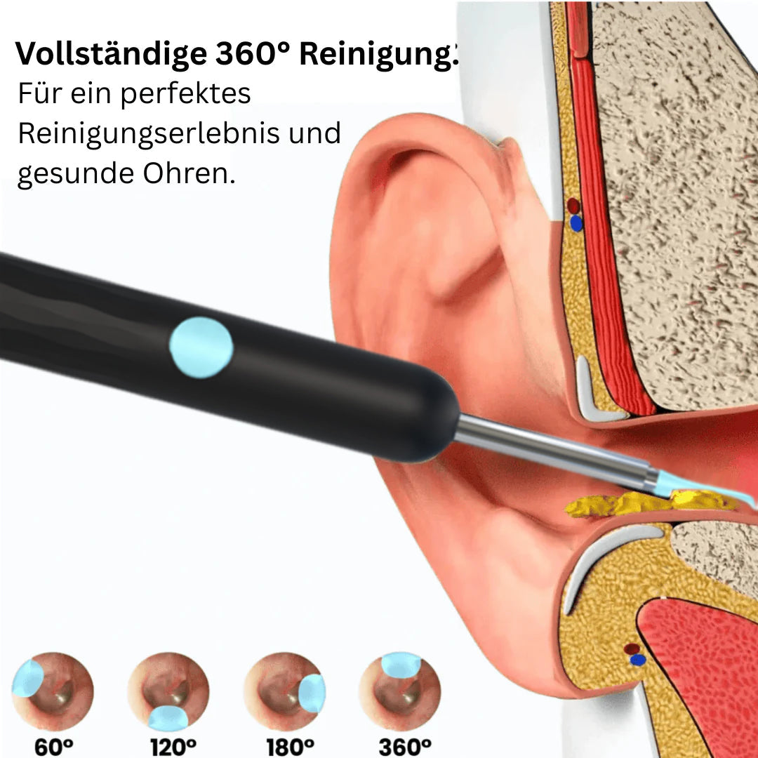 ā³Limited time 50% discountš„Intelligent waterproof visual earwax remover