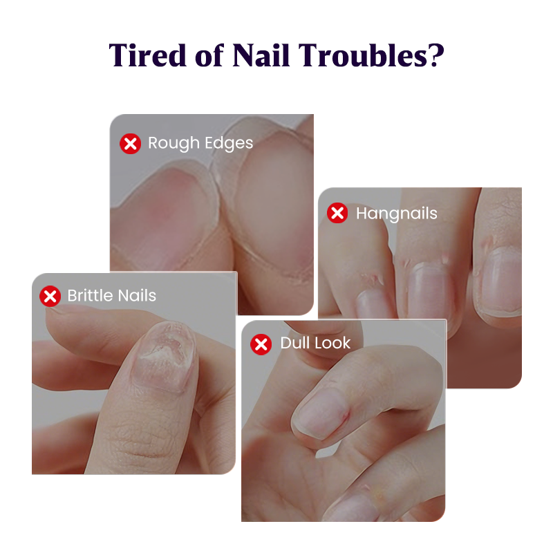 💜Christmas Sale 50% OFF💜2026 New Upgraded 3-in-1 Nail Care Pen💅